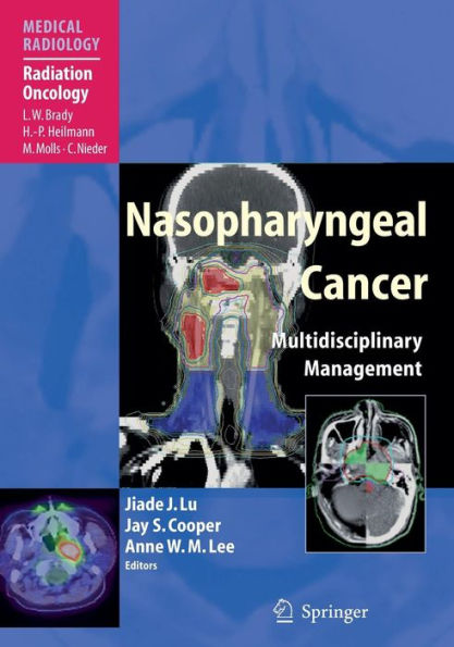 Nasopharyngeal Cancer: Multidisciplinary Management / Edition 1