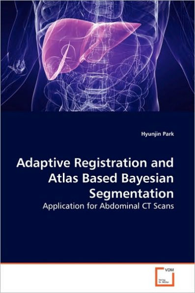 Adaptive Registration and Atlas Based Bayesian Segmentation