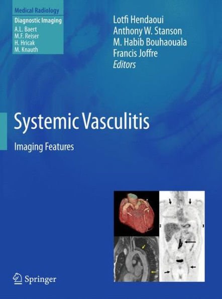 Systemic Vasculitis: Imaging Features / Edition 1