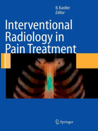 Title: Interventional Radiology in Pain Treatment / Edition 1, Author: Bruno Kastler