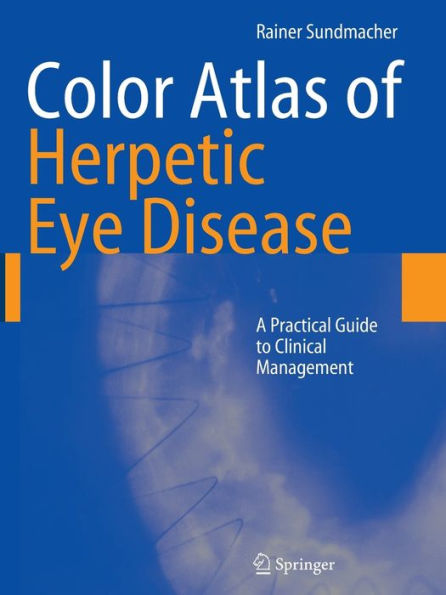 Color Atlas of Herpetic Eye Disease: A Practical Guide to Clinical Management / Edition 1