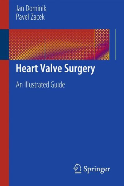 Heart Valve Surgery: An Illustrated Guide / Edition 1