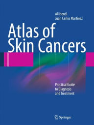 Title: Atlas of Skin Cancers: Practical Guide to Diagnosis and Treatment / Edition 1, Author: Ali Hendi