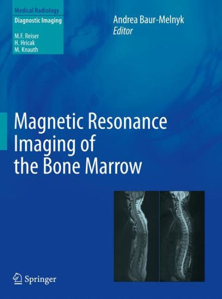Magnetic Resonance Imaging of the Bone Marrow / Edition 1
