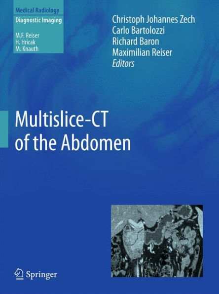 Multislice-CT of the Abdomen / Edition 1