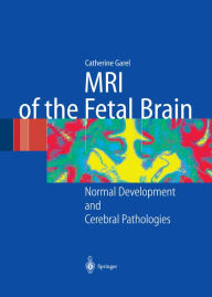 Title: MRI of the Fetal Brain: Normal Development and Cerebral Pathologies, Author: C. Garel