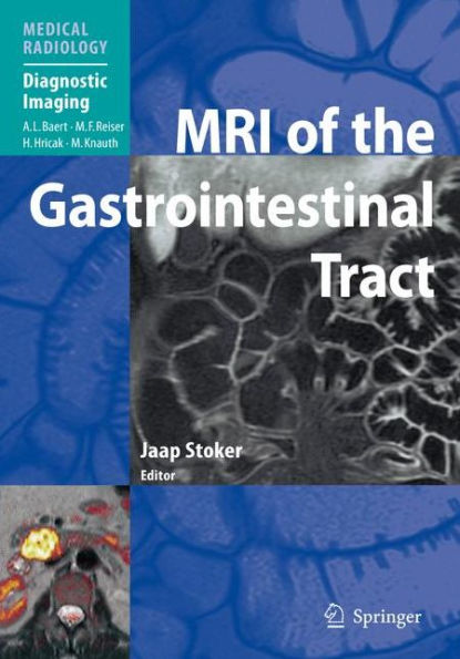 MRI of the Gastrointestinal Tract / Edition 1