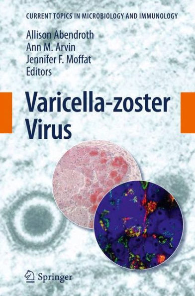 Varicella-zoster Virus / Edition 1
