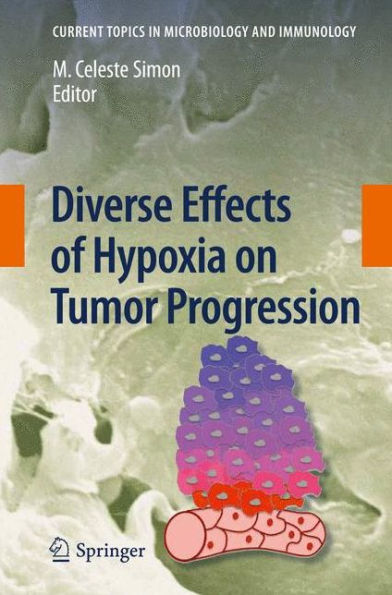 Diverse Effects of Hypoxia on Tumor Progression / Edition 1