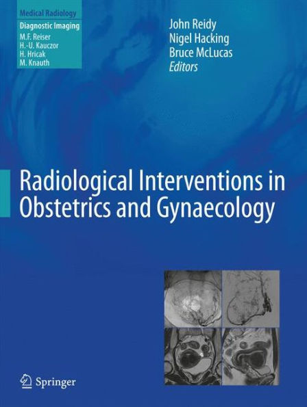 Radiological Interventions in Obstetrics and Gynaecology / Edition 1