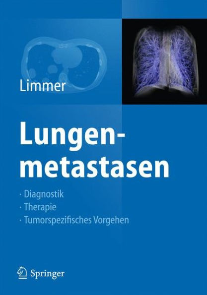 Lungenmetastasen: Diagnostik - Therapie - Tumorspezifisches Vorgehen