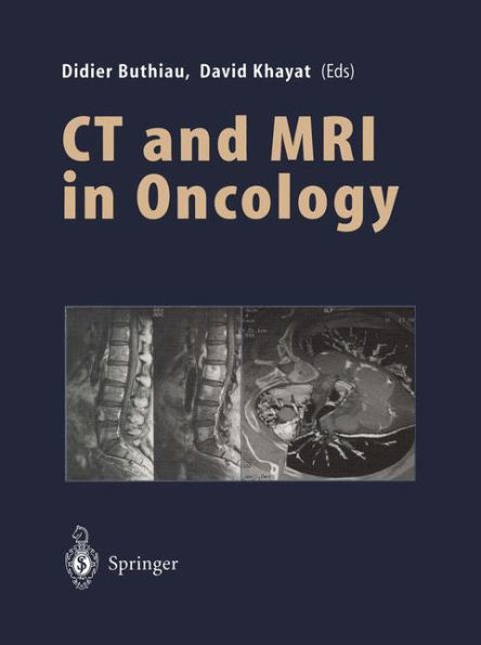 CT and MRI in Oncology / Edition 1