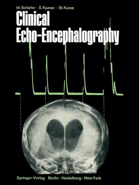 Clinical Echo-Encephalography / Edition 1
