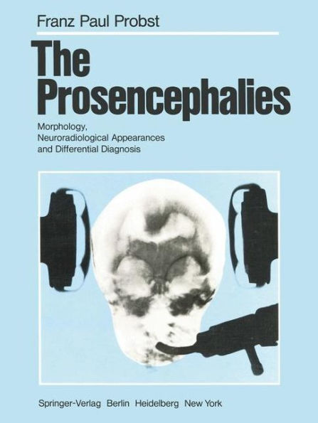 The Prosencephalies: Morphology, Neuroradiological Appearances and Differential Diagnosis / Edition 1