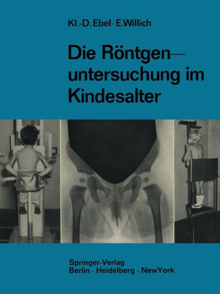 Die Röntgenuntersuchung im Kindesalter: Technik und Indikation