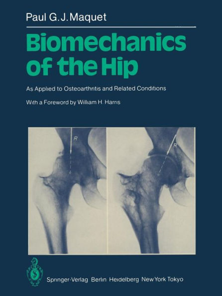 Biomechanics of the Hip: As Applied to Osteoarthritis and Related Conditions / Edition 1