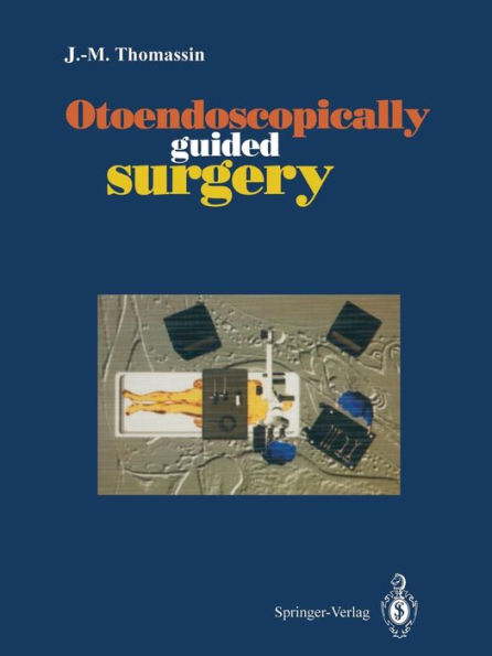 Otoendoscopically guided surgery / Edition 1