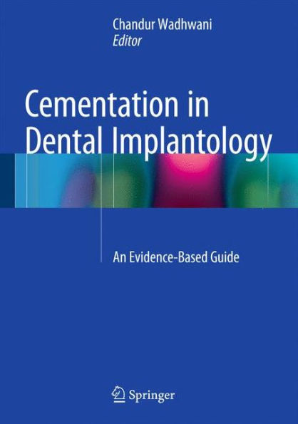 Cementation in Dental Implantology: An Evidence-Based Guide