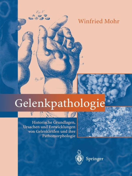 Gelenkpathologie: Historische Grundlagen, Ursachen und Entwicklungen von Gelenkleiden und ihre Pathomorphologie