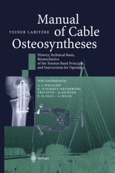 Manual of Cable Osteosyntheses: History, Technical Basis, Biomechanics of the Tension Band Principle, and Instructions for Operation / Edition 1