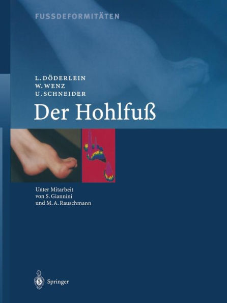 Fussdeformitï¿½ten: Der Hohlfuss