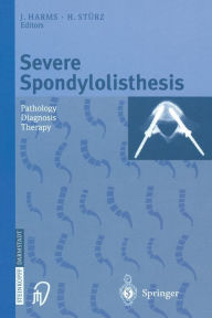 Title: Severe Spondylolisthesis: Pathology - Diagnosis - Therapy, Author: J. Harms