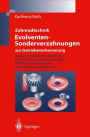 Zahnradtechnik Evolventen-Sonderverzahnungen zur Getriebeverbesserung: Evoloid-, Komplement-, Keilschräg-, Konische-, Konus-, Kronenrad-, Torus-, Wälzkolbenverzahnungen, Zahnrad-Erzeugungsverfahren