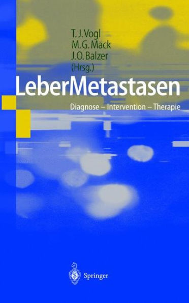 LeberMetastasen: Diagnose - Intervention - Therapie