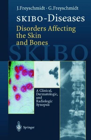 SKIBO-Diseases Disorders Affecting the Skin and Bones: A Clinical, Dermatologic, and Radiologic Synopsis