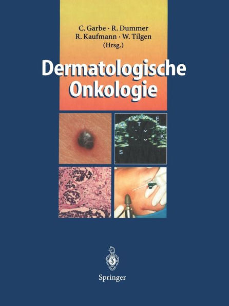 Dermatologische Onkologie