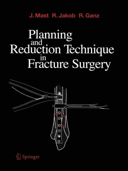 Planning and Reduction Technique in Fracture Surgery