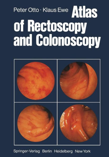Atlas of Rectoscopy and Coloscopy / Edition 1