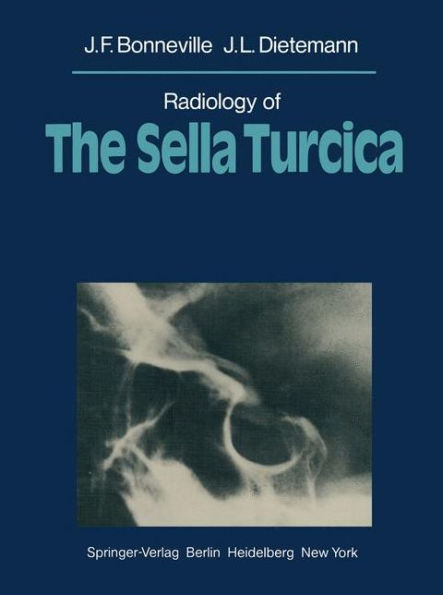 Radiology of The Sella Turcica / Edition 1