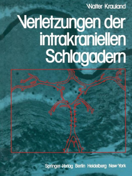 Verletzungen der intrakraniellen Schlagadern