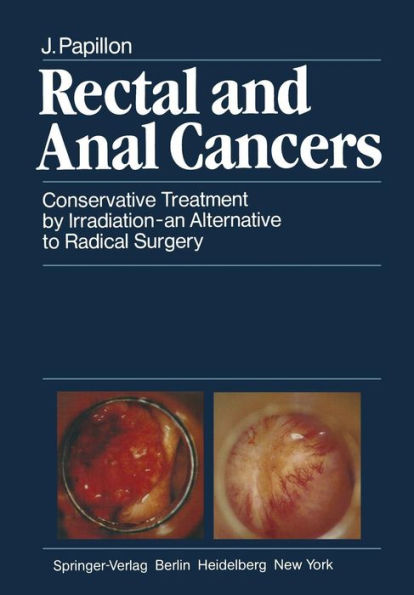 Rectal and Anal Cancers: Conservative Treatment by Irradiation - an Alternative to Radical Surgery / Edition 1