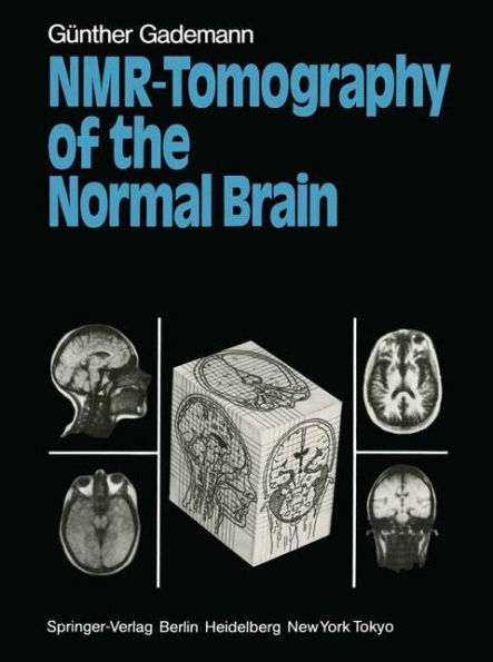 NMR-Tomography of the Normal Brain / Edition 1