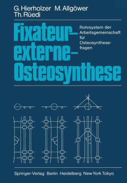 Fixateur-externe-Osteosynthese: Rohrsystem der Arbeitsgemeinschaft für Osteosynthesefragen