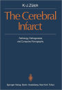 The Cerebral Infarct: Pathology, Pathogenesis, and Computed Tomography