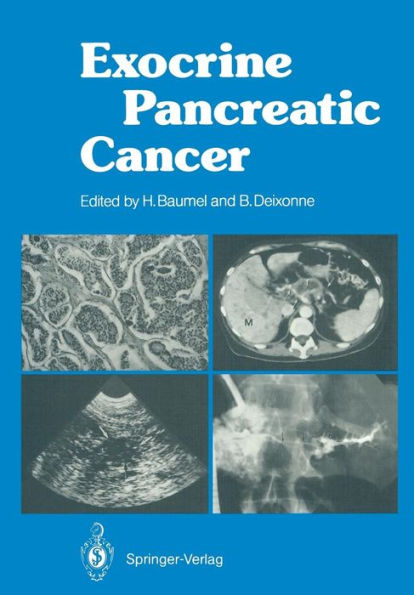Exocrine Pancreatic Cancer / Edition 1