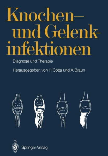 Knochen- und Gelenkinfektionen: Diagnose und Therapie 5. Heidelberger Orthopï¿½die-Symposium / Edition 1