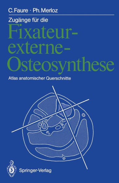 Zugï¿½nge fï¿½r die Fixateur-externe-Osteosynthese: Atlas anatomischer Querschnitte