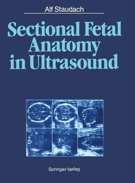 Sectional Fetal Anatomy in Ultrasound / Edition 1