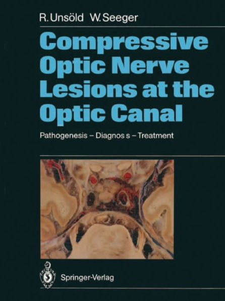 Compressive Optic Nerve Lesions at the Optic Canal: Pathogenesis - Diagnosis - Treatment / Edition 1