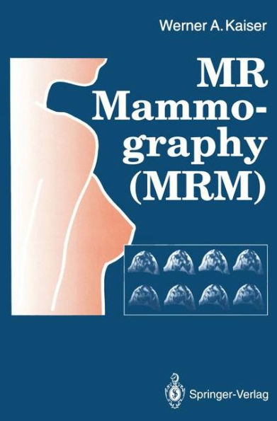 MR Mammography (MRM) / Edition 1