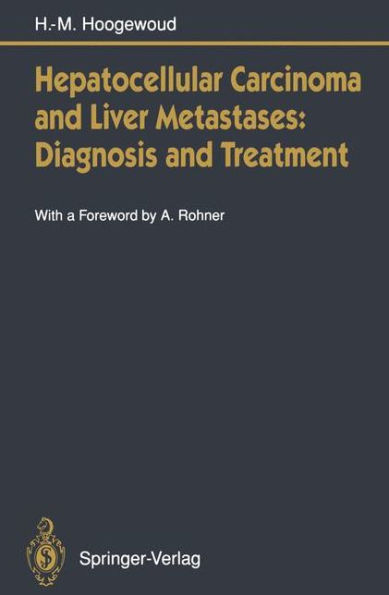 Hepatocellular Carcinoma and Liver Metastases: Diagnosis and Treatment / Edition 1