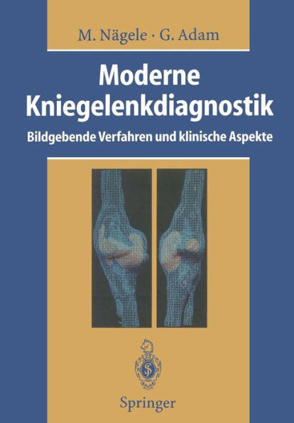 Moderne Kniegelenkdiagnostik: Bildgebende Verfahren und klinische Aspekte