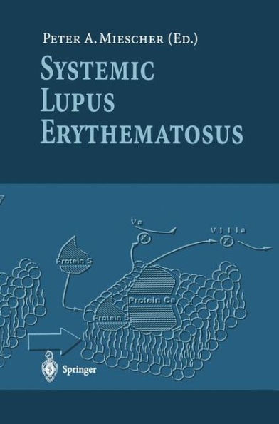 Systemic Lupus Erythematosus / Edition 1