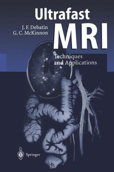 Ultrafast MRI: Techniques and Applications / Edition 1