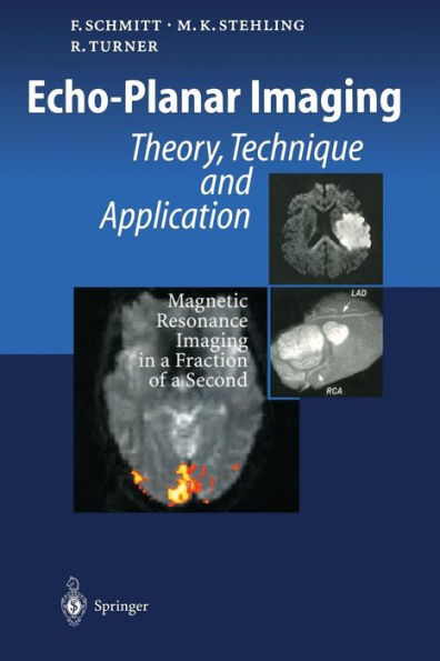 Echo-Planar Imaging: Theory, Technique and Application