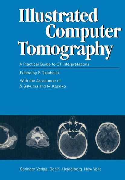 Illustrated Computer Tomography: A Practical Guide to CT Interpretations / Edition 1